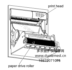 GE DASH5000監(jiān)護儀如何清潔打印頭